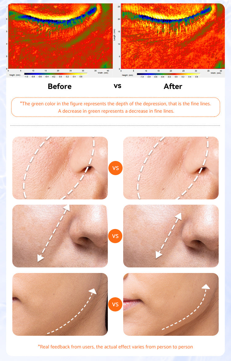 DL039 Prospera Penguin LED Sculpt Pro - Red/blue light, FDA Approved, Whole body Microcurrent EMS System