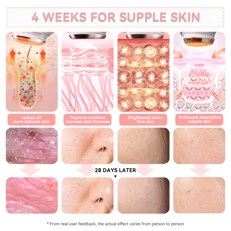 DL039 Prospera Penguin LED Sculpt Pro - Red/blue light, FDA Approved, Whole body Microcurrent EMS System