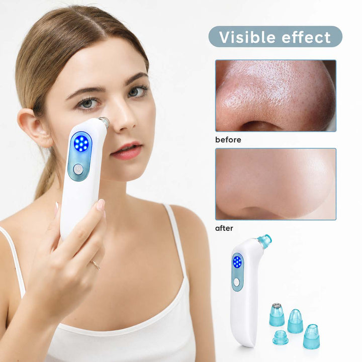 ML001 Blackhead Remover