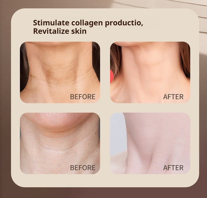 DL035A Panther II LED Skin Rejuvenate Face and Neck Mask, FDA Approved